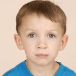 Cleft lip and palate Before & After Patient #1573