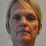Facelift Before & After Patient #1608