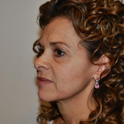 Facelift Before & After Patient #1594