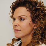 Facelift Before & After Patient #1594