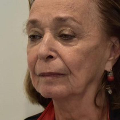 Facelift Before & After Patient #1596