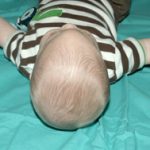Pediatric Treatments Before & After Patient #2789