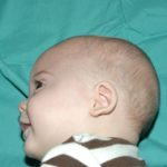 Pediatric Treatments Before & After Patient #2789