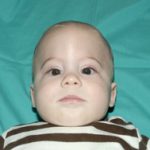 Pediatric Treatments Before & After Patient #2789