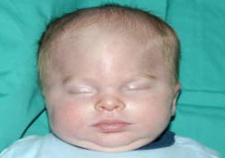 Pediatric Treatments Before & After Patient #2790