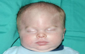 Pediatric Treatments Before & After Patient #2790