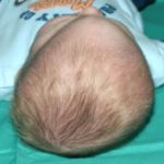 Pediatric Treatments Before & After Patient #2790