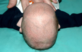 Pediatric Treatments Before & After Patient #2791