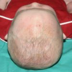 Pediatric Treatments Before & After Patient #2791