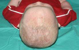 Pediatric Treatments Before & After Patient #2791