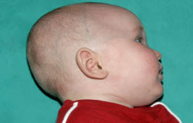 Pediatric Treatments Before & After Patient #2791