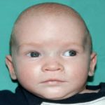 Pediatric Treatments Before & After Patient #2791