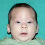 Pediatric Treatments Before & After Patient #2792