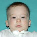 Pediatric Treatments Before & After Patient #2792