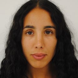 Rhinoplasty Before & After Patient #2234