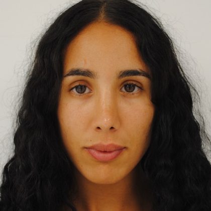 Rhinoplasty Before & After Patient #2234