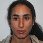 Rhinoplasty Before & After Patient #2234