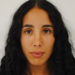 Rhinoplasty Before & After Patient #2234