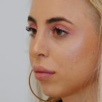 Rhinoplasty Before & After Patient #2235