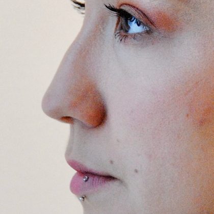 Rhinoplasty Before & After Patient #2240